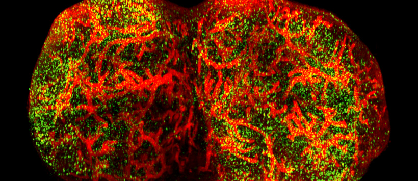 Wybarwione naczynia krwionośne myszy (kolor czerwony) oraz limfocyty T CD8+ (kolor zielony)