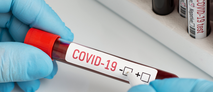fiolka z napisem COVID-19; laborant wpisuje znak minus na etykiecie