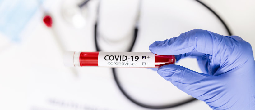 Probówka z napisem COVID-19 trzymana w dłoni przez laboranta