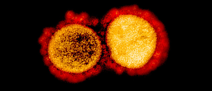 Wirus SARS-CoV-2 widziany pod mikroskopem